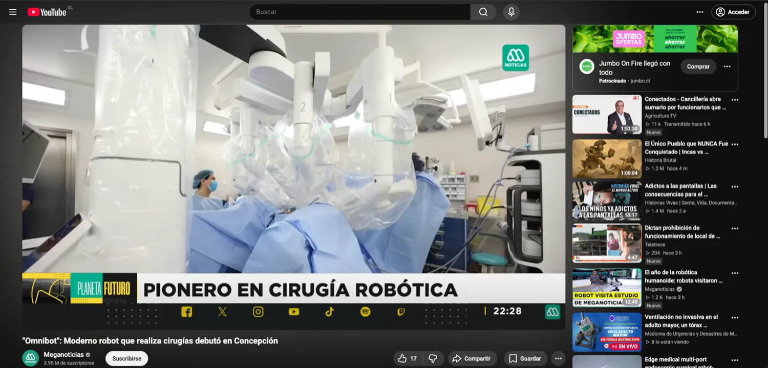 Cobertura de Meganoticias sobre la cirugía con robot Omnibot en Clínica Andes Salud — con material audiovisual producido por Octopus Media